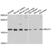 Western blot analysis of extracts of various cell lines, using Ribosomal Protein Lateral Stalk Subunit P1 Antibody (1/1000 dilution) followed by <a href="https://www.abbexa.com/index.php?route=product/search&search=abx005548" target="_blank">abx005548</a> - Goat Anti-Rabbit IgG, H+L (1/10000 dilution) and 3% non-fat dry milk in TBST for blocking.