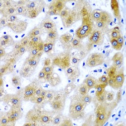 Selenocysteine Insertion Sequence-Binding Protein 2 (SECISBP2) Antibody