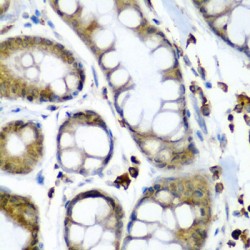 Selenocysteine Insertion Sequence-Binding Protein 2 (SECISBP2) Antibody