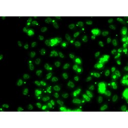 Selenocysteine Insertion Sequence-Binding Protein 2 (SECISBP2) Antibody