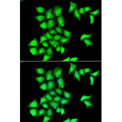 Methionine-R-Sulfoxide Reductase B1 (MSRB1) Antibody