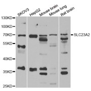 Western blot analysis of extracts of various cell lines, using SLC23A2 antibody (abx005171) at 1/1000 dilution.