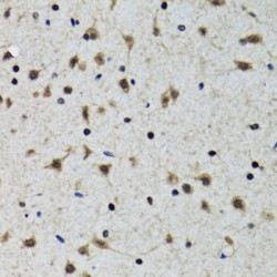 Solute Carrier Family 23 Member 2 (SLC23A2) Antibody