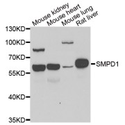 Western blot analysis of extracts of various cell lines, using SMPD1 antibody (abx005173) at 1/1000 dilution.