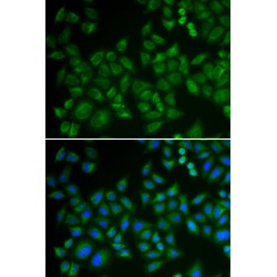 Sphingomyelin Phosphodiesterase (SMPD1) Antibody