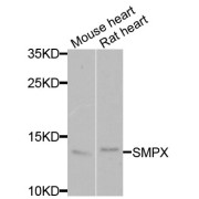 Western blot analysis of extracts of various cell lines, using SMPX antibody (abx005174) at 1/1000 dilution.