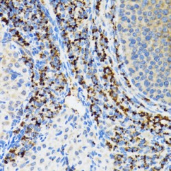 Signal Recognition Particle 19 (SRP19) Antibody