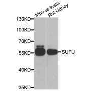 Western blot analysis of extracts of various cell lines, using SUFU antibody (abx005181) at 1/1000 dilution.