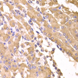 SUFU Negative Regulator of Hedgehog Signaling (SUFU) Antibody