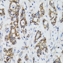 SURF1, Cytochrome C Oxidase Assembly Factor (SURF1) Antibody