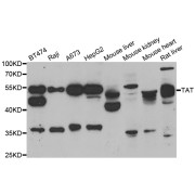 Western blot analysis of extracts of various cell lines, using TAT antibody (abx005188) at 1/1000 dilution.