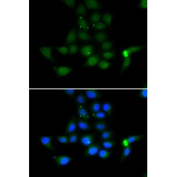 Tyrosine Aminotransferase (TAT) Antibody