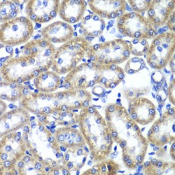 Transmembrane Emp24 Domain-Containing Protein 10 (TMED10) Antibody