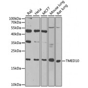 Western blot analysis of extracts of various cell lines, using TMED10 antibody (abx005193) at 1/1000 dilution.