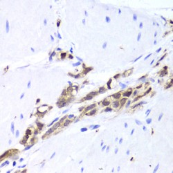 Tubulin Polymerization-Promoting Protein Family Member 3 (TPPP3) Antibody