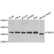 Western blot analysis of extracts of various cell lines, using TREX1 antibody (abx005200) at 1/1000 dilution.