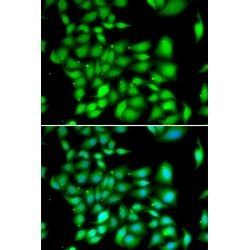 Three Prime Repair Exonuclease 1 (TREX1) Antibody