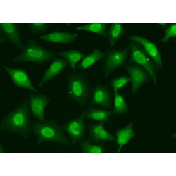 Three Prime Repair Exonuclease 1 (TREX1) Antibody