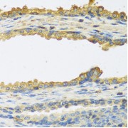 Immunohistochemistry of paraffin-embedded human prostate using TSHB antibody (abx005202) at dilution of 1/100 (40x lens).