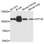 Western blot analysis of extracts of various cell lines, using CPT1B antibody (abx005212) at 1/1000 dilution.