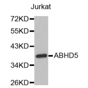 Western blot analysis of extracts of Jurkat cells, using ABHD5 antibody (abx005216).