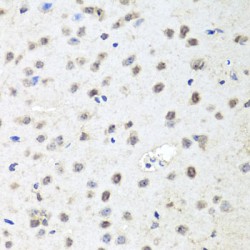 Protein Argonaute-2 (EIF2C2) Antibody