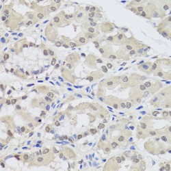 Protein Argonaute-2 (EIF2C2) Antibody