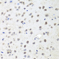 Protein Argonaute-2 (EIF2C2) Antibody