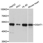 Western blot analysis of extracts of various cell lines, using DGAT1 antibody (abx005229) at 1/1000 dilution.