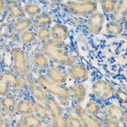 Complement C1s Subcomponent (C1S) Antibody