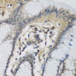 Complement C1s Subcomponent (C1S) Antibody