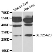 Western blot analysis of extracts of various cell lines, using SLC25A20 antibody (abx005239) at 1/1000 dilution.