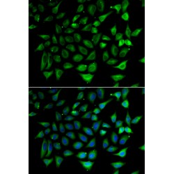 Mitochondrial Carnitine/Acylcarnitine Carrier Protein (SLC25A20) Antibody