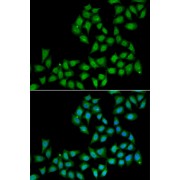 Immunofluorescence analysis of A549 cells using ELF1 antibody (abx005248). Blue: DAPI for nuclear staining.