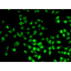 GA Binding Protein Subunit Beta 1 (GABPB1) Antibody