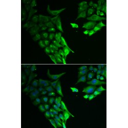 Hyaluronan Binding Protein 2 (HABP2) Antibody