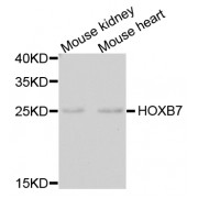 Western blot analysis of extracts of various cell lines, using HOXB7 antibody (abx005261) at 1/1000 dilution.