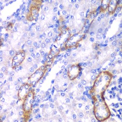 Myosin IC (MYO1C) Antibody