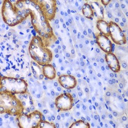 Myosin IC (MYO1C) Antibody