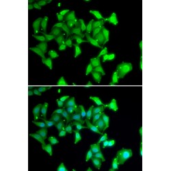 Myosin IC (MYO1C) Antibody