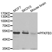 Western blot analysis of extracts of various cell lines, using PFKFB3 antibody (abx005268) at 1/1000 dilution.