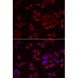 6-Phosphofructo-2-Kinase/Fructose-2,6-Biphosphatase 3 (PFKFB3) Antibody