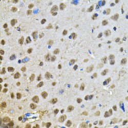 Peptidylprolyl Isomerase D / CYPD (PPID) Antibody