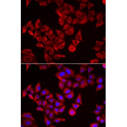 Serglycin (SRGN) Antibody