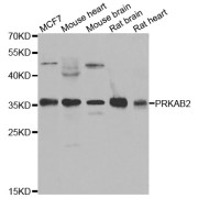 Western blot analysis of extracts of various cell lines, using PRKAB2 antibody (abx005275) at 1/1000 dilution.