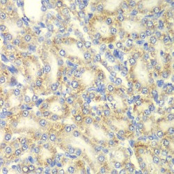 Protein Kinase, AMP Activated Beta 2 (PRKAB2) Antibody