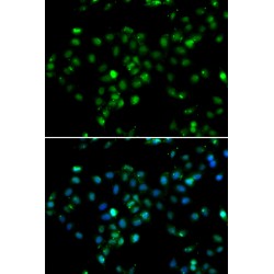 Histone-Binding Protein RBBP6 (RBBP6) Antibody