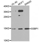 Western blot analysis of extracts of various cell lines, using SSBP1 antibody (abx005297) at 1/1000 dilution.