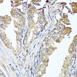 Serine/Threonine Kinase 3 (STK3) Antibody