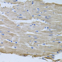 Threonyl tRNA Synthetase, Cytoplasmic (TARS) Antibody